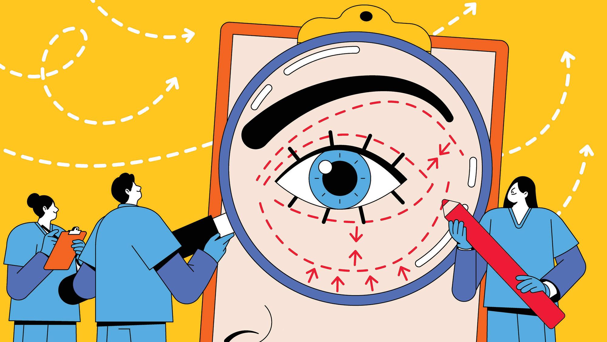 illustration of medical staff marking around a woman's eye pre-surgery